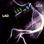 Biomaterials