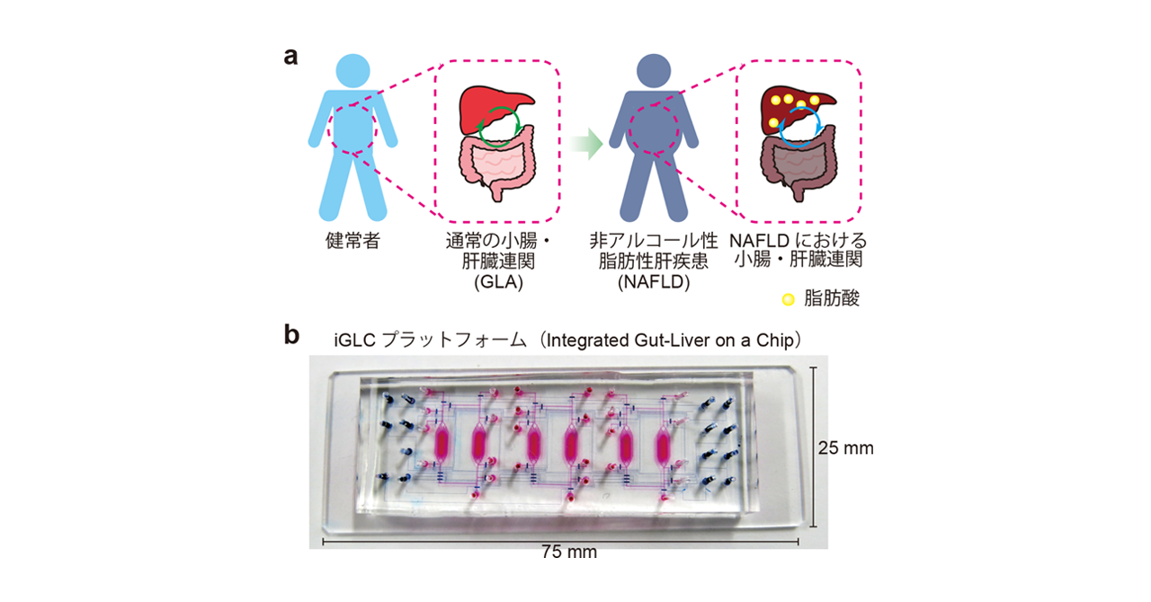 甲状腺機能低下症は脂肪肝を引き起こすのでしょうか?
